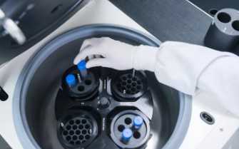 全国供卵试管婴儿医院有哪些,鞍形*试管可以做吗？有哪些影响？