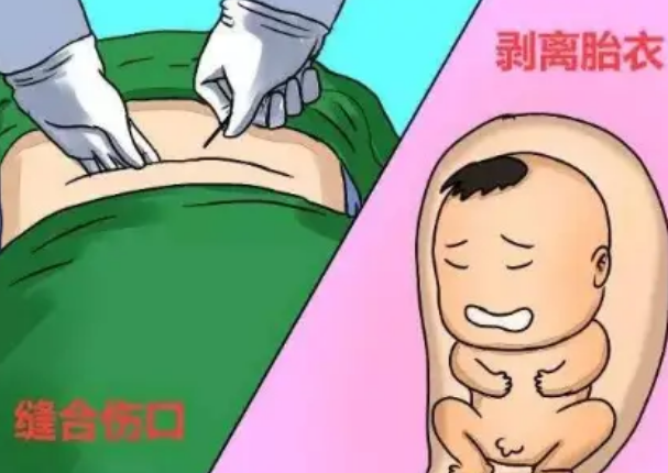 国内代孕公司咨询服务,双胞胎试管婴儿*率是多少？