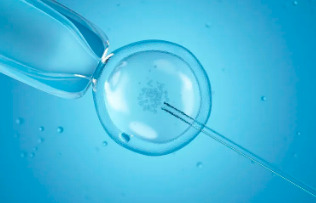 国内代生男孩费用,试管黄体期方案，促排卵时间与优缺点对比