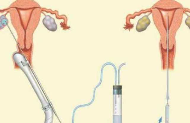 全国供卵试管医院排行,2026试管婴儿包生男孩的秘密分享！囊胚什么级别更容易生儿子？